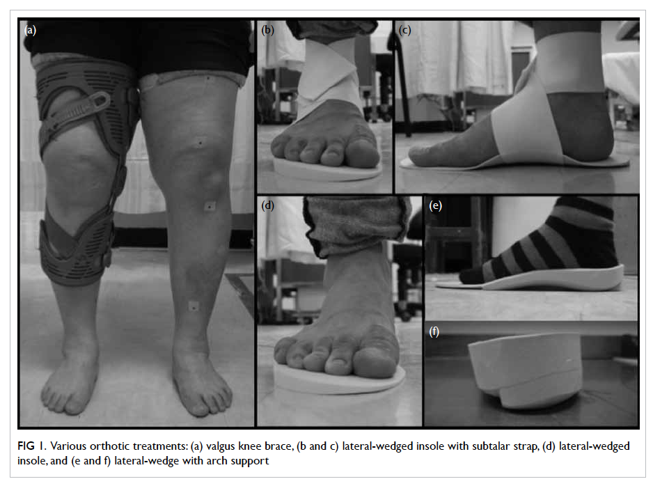 lateral wedge insoles for medial knee osteoarthritis