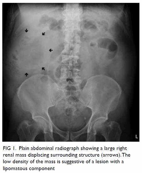 Differential Diagnosis of Flank Pain, PDF, Kidney