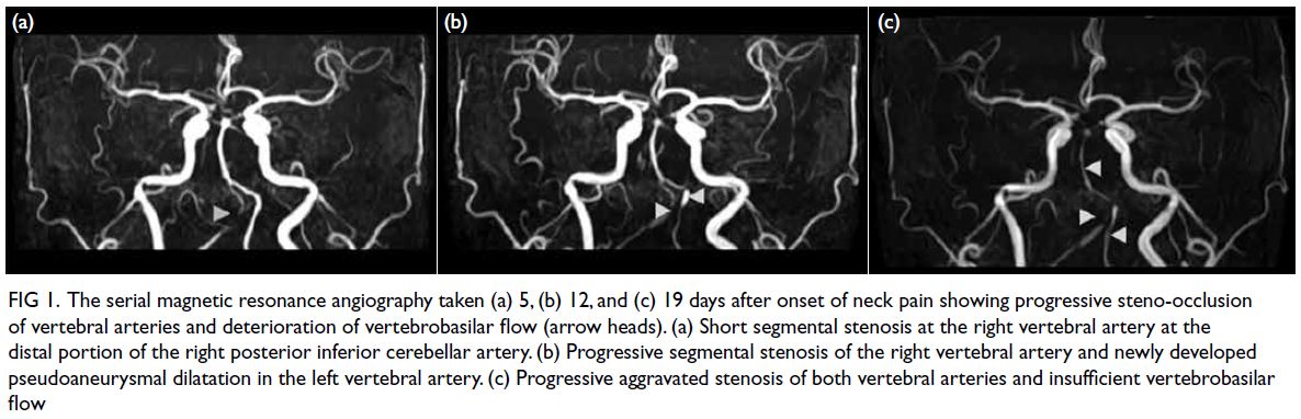 vertebral artery